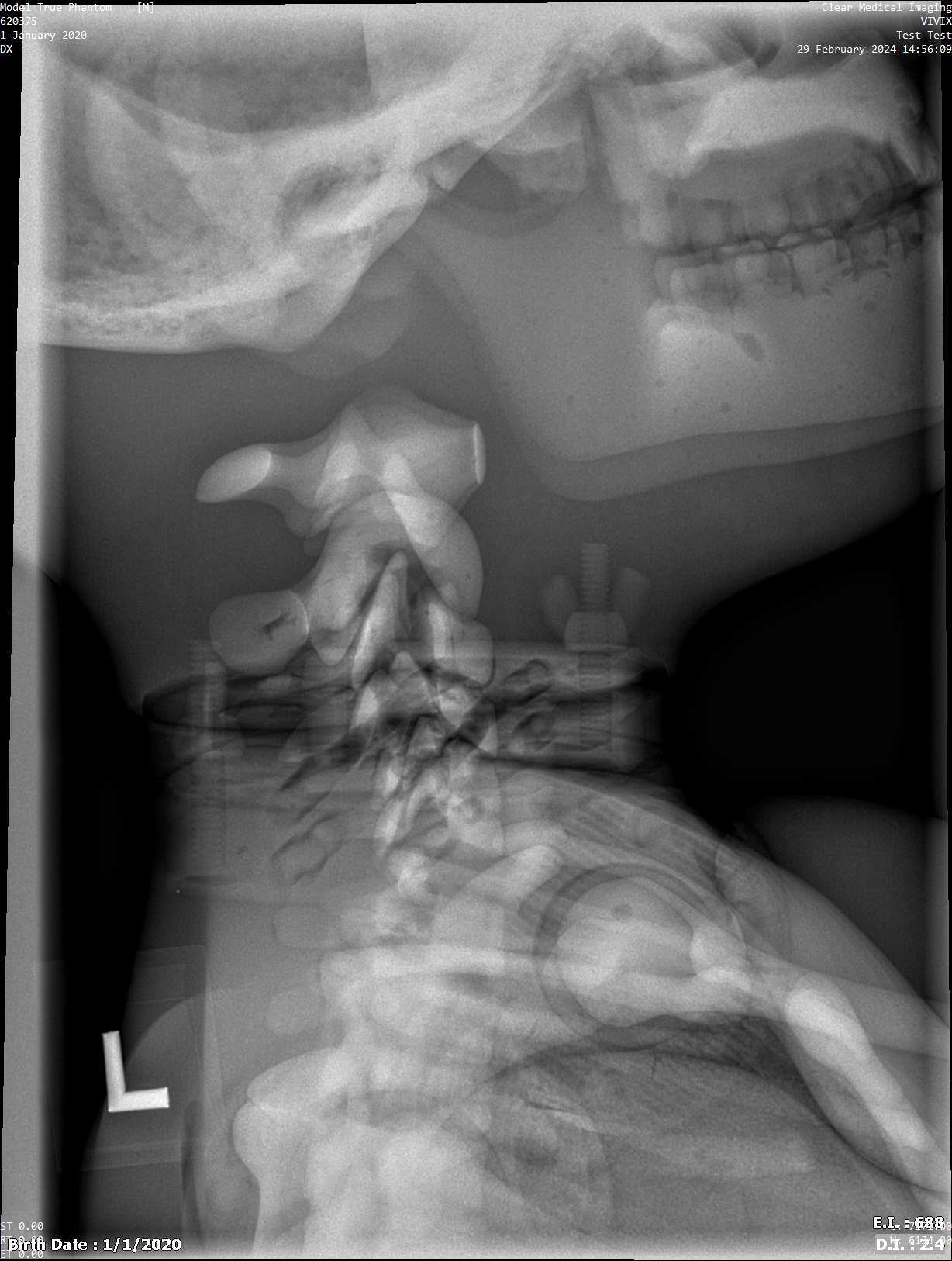 X-Ray Scans