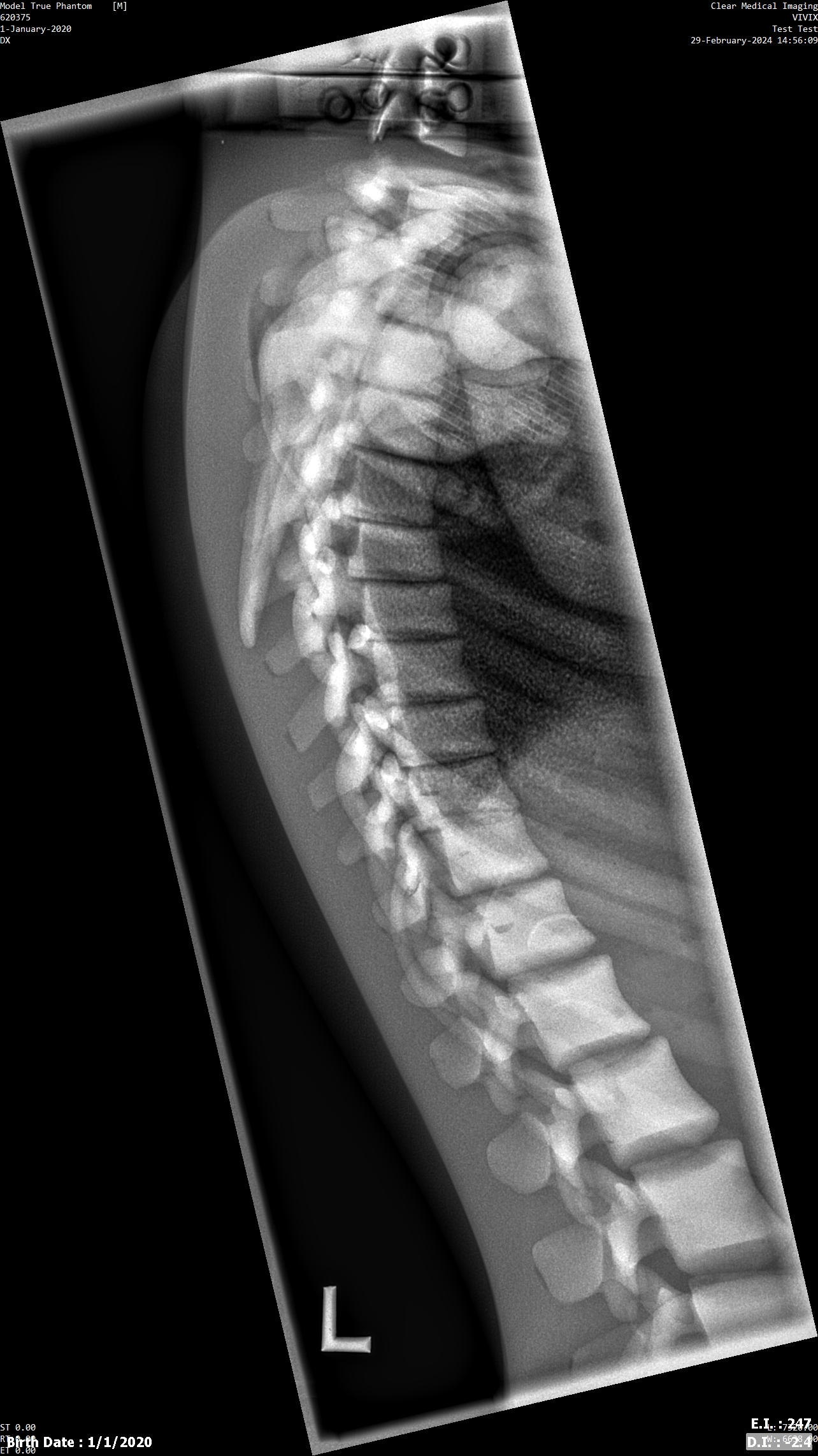 X-Ray Scans