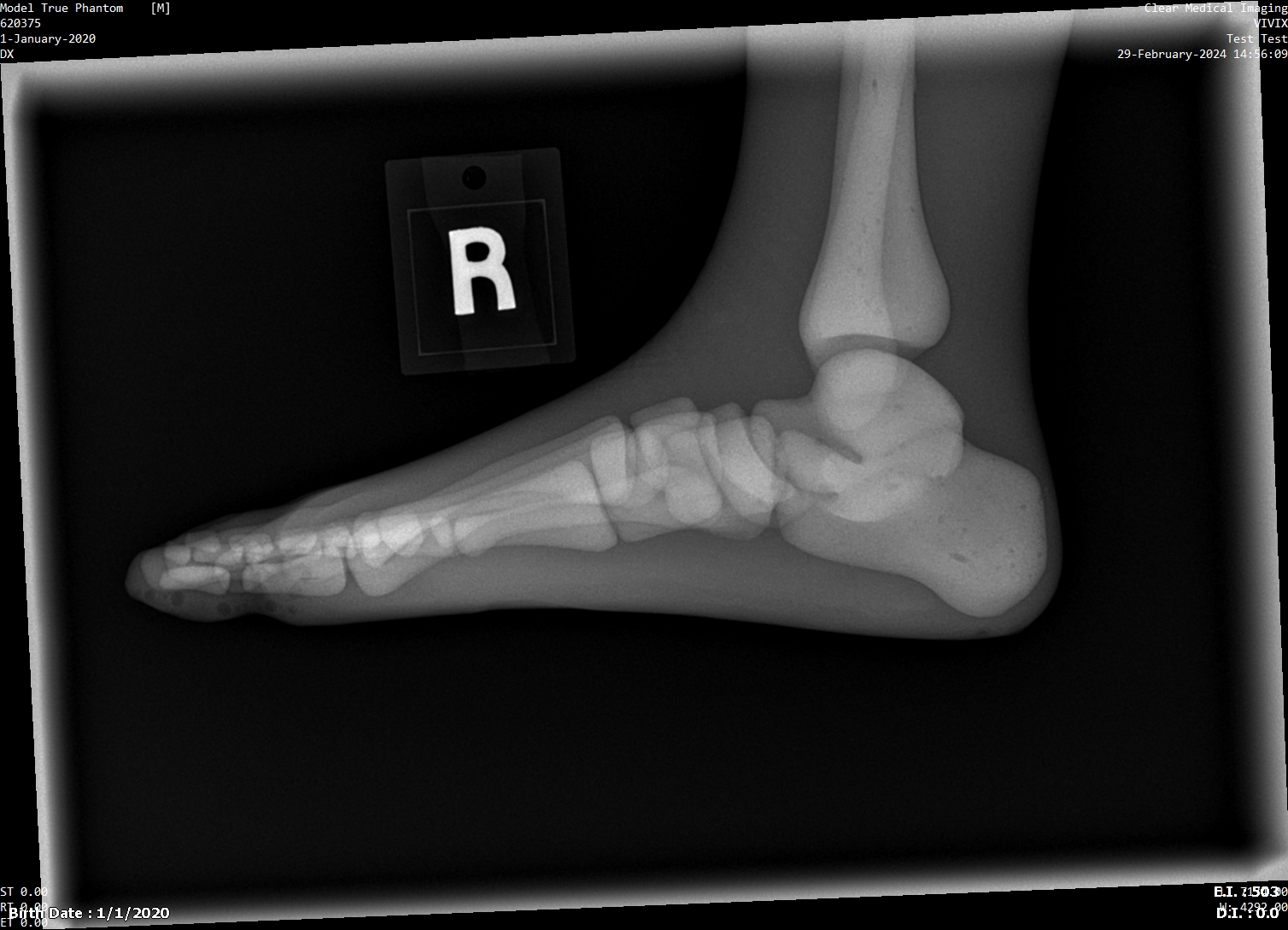 X-Ray Scans