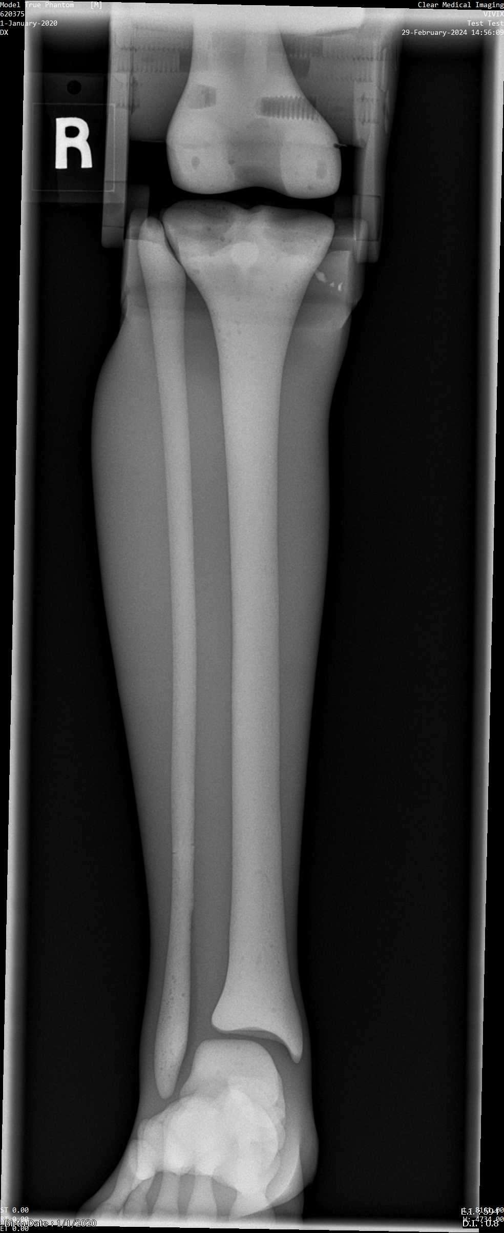 X-Ray Scans