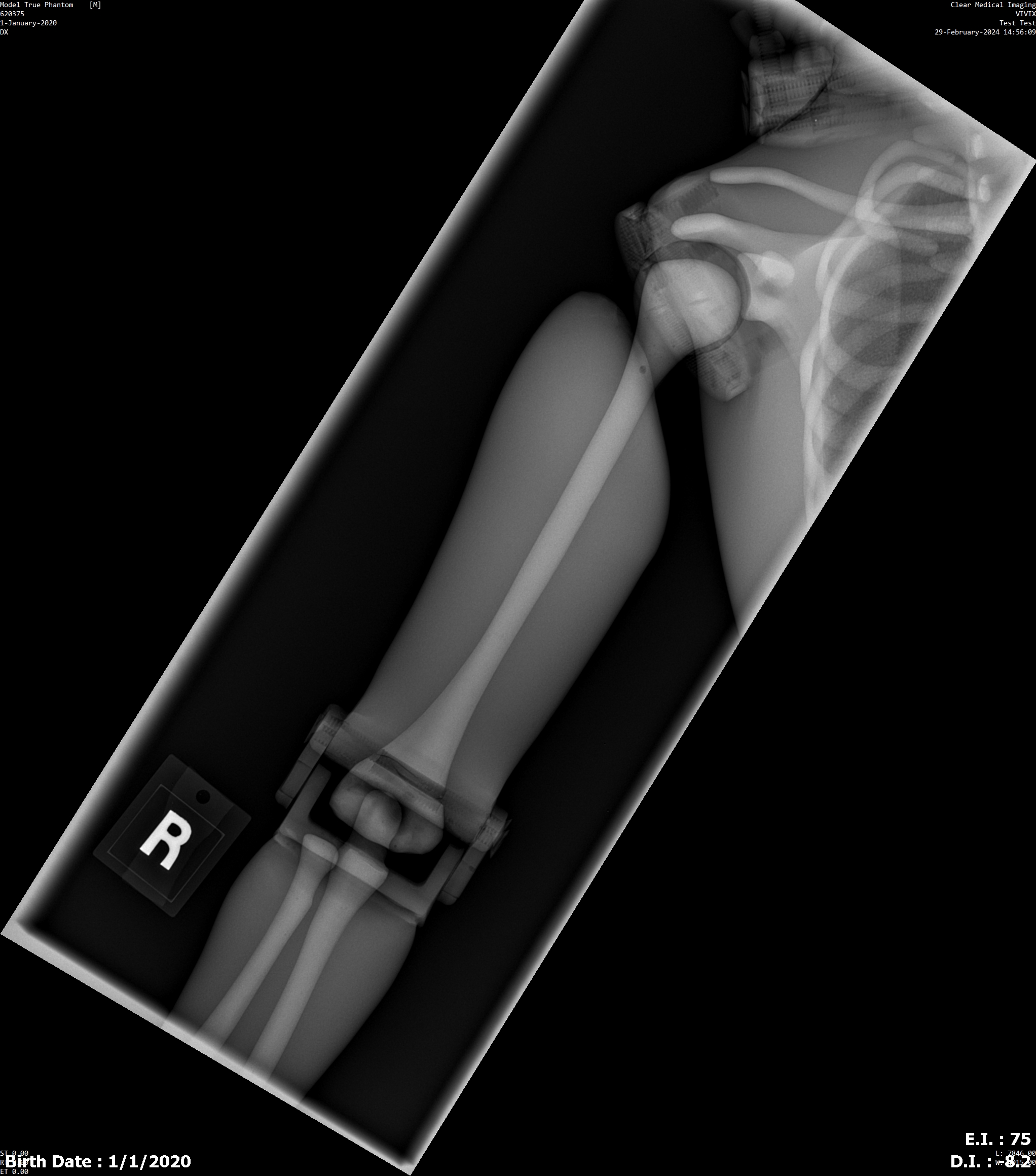 X-Ray Scans