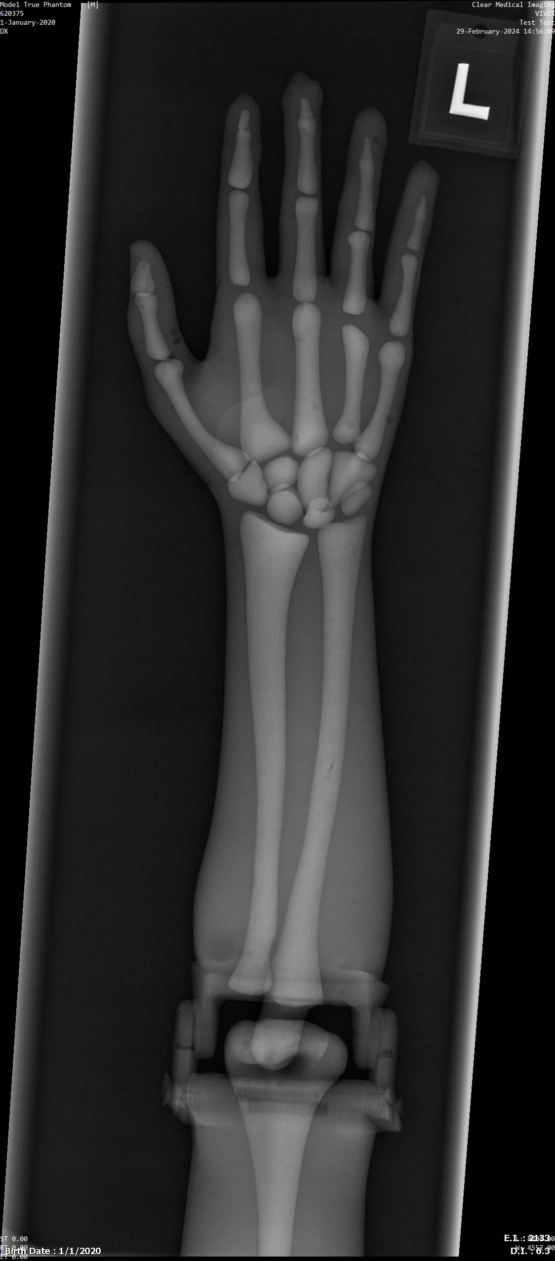 X-Ray Scans