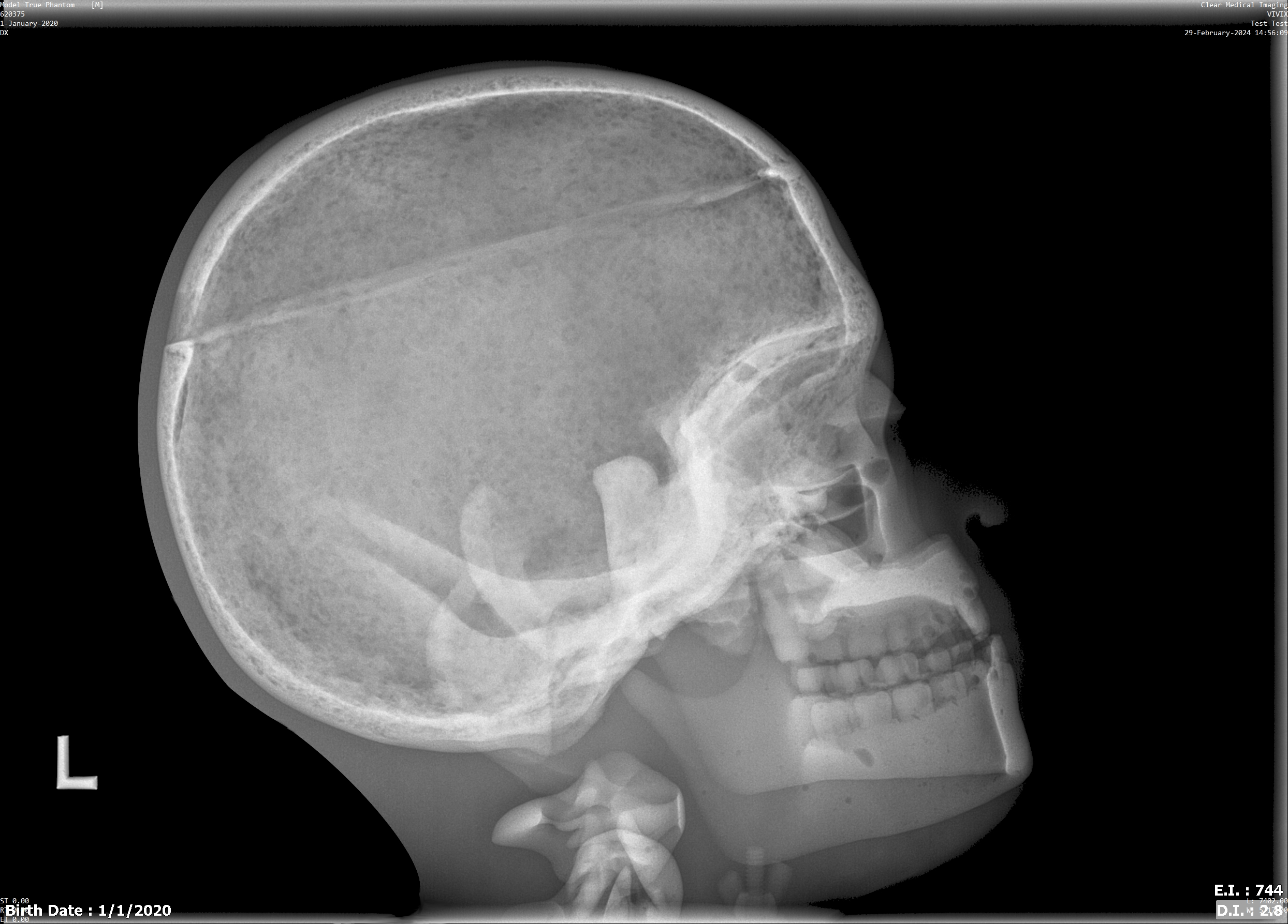 X-Ray Scans