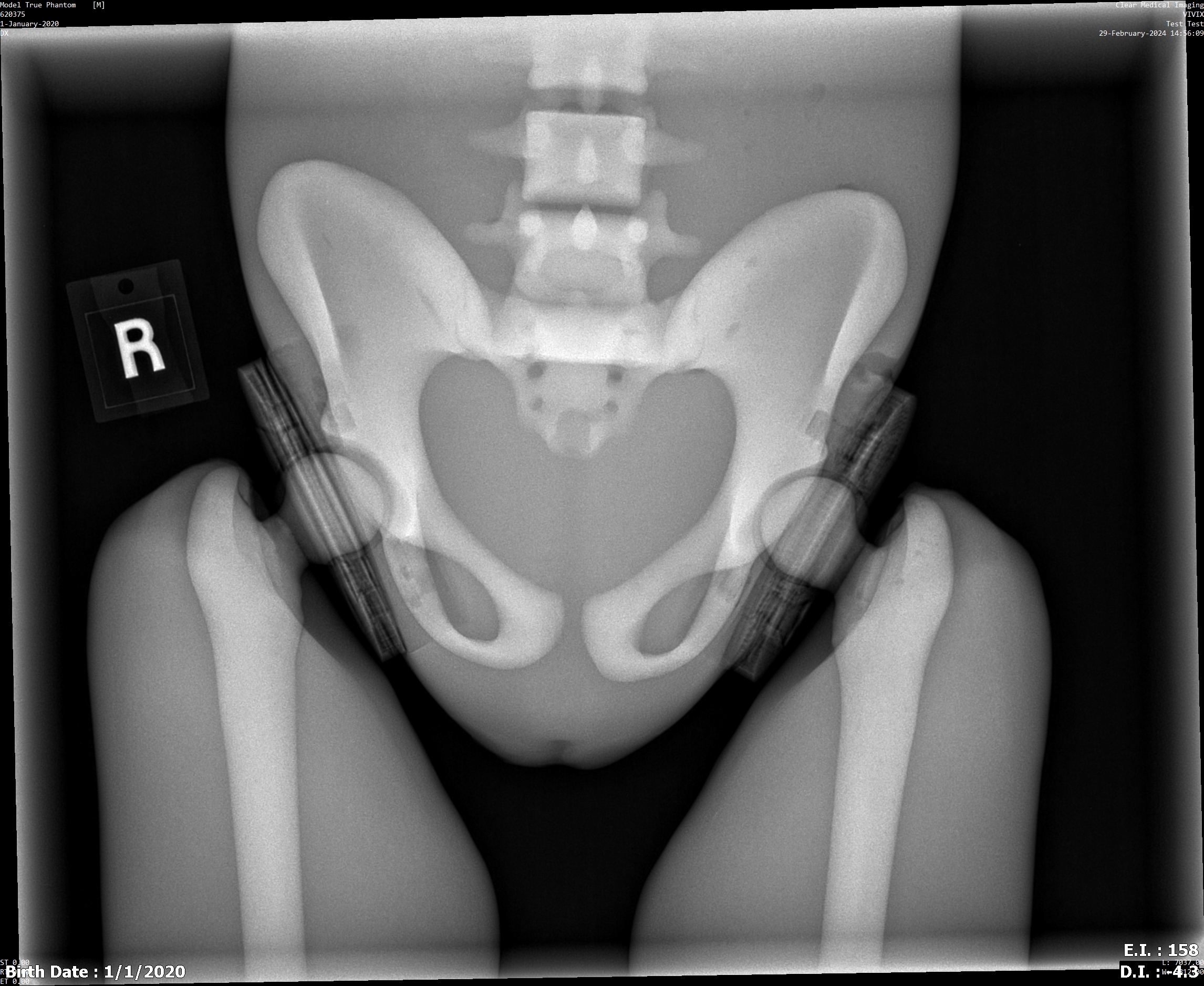 X-Ray Scans