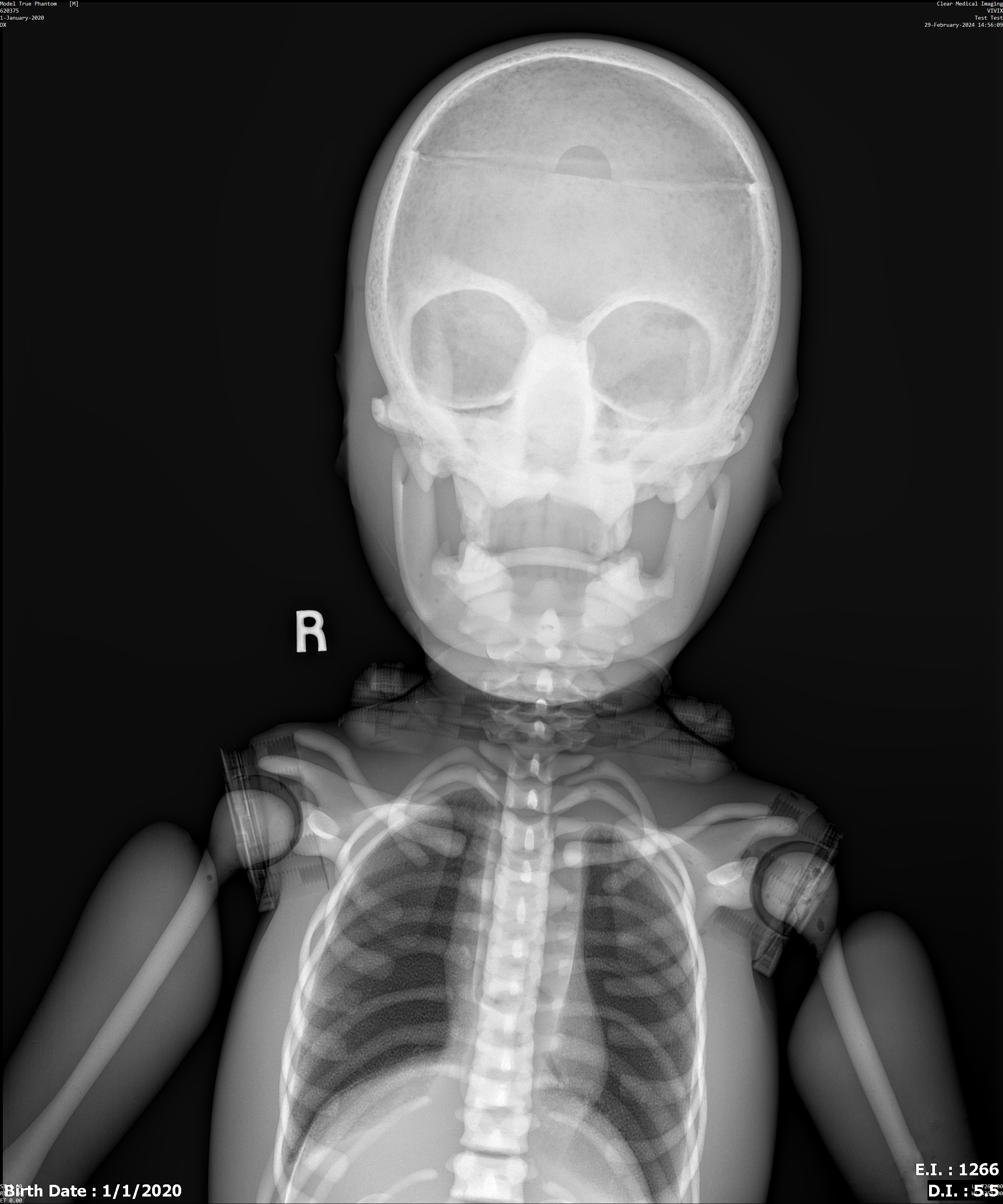 X-Ray Scans