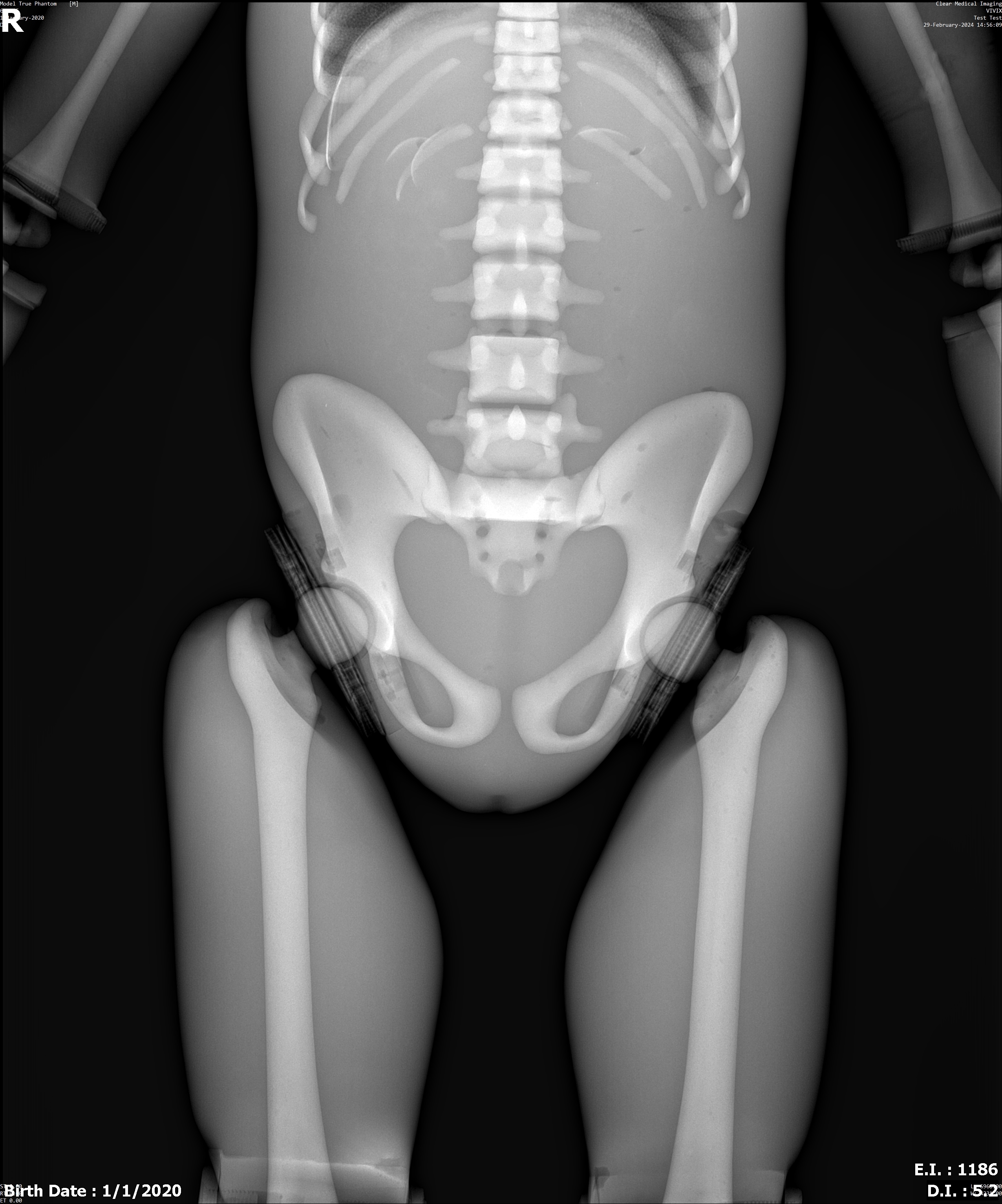 X-Ray Scans
