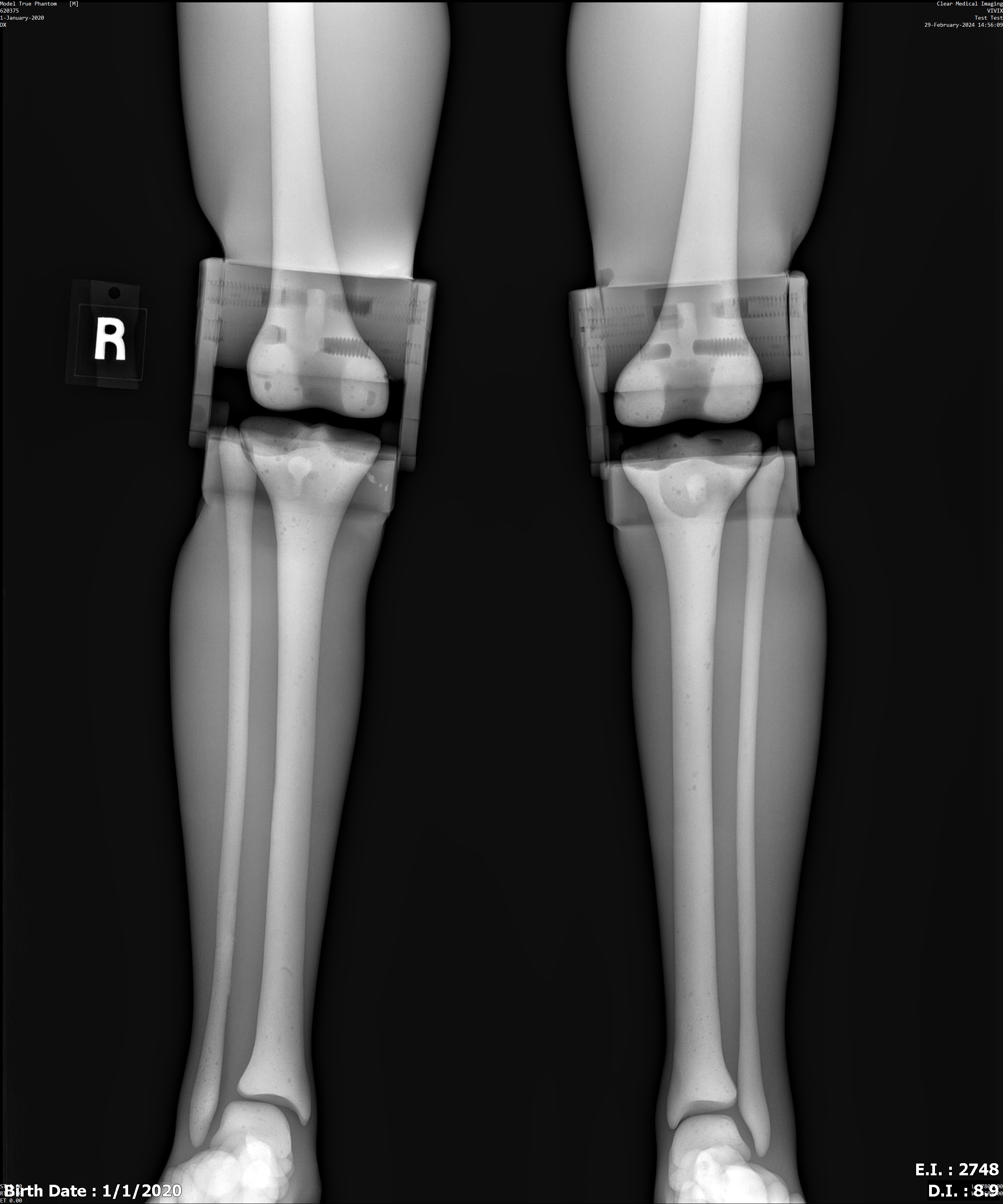 X-Ray Scans