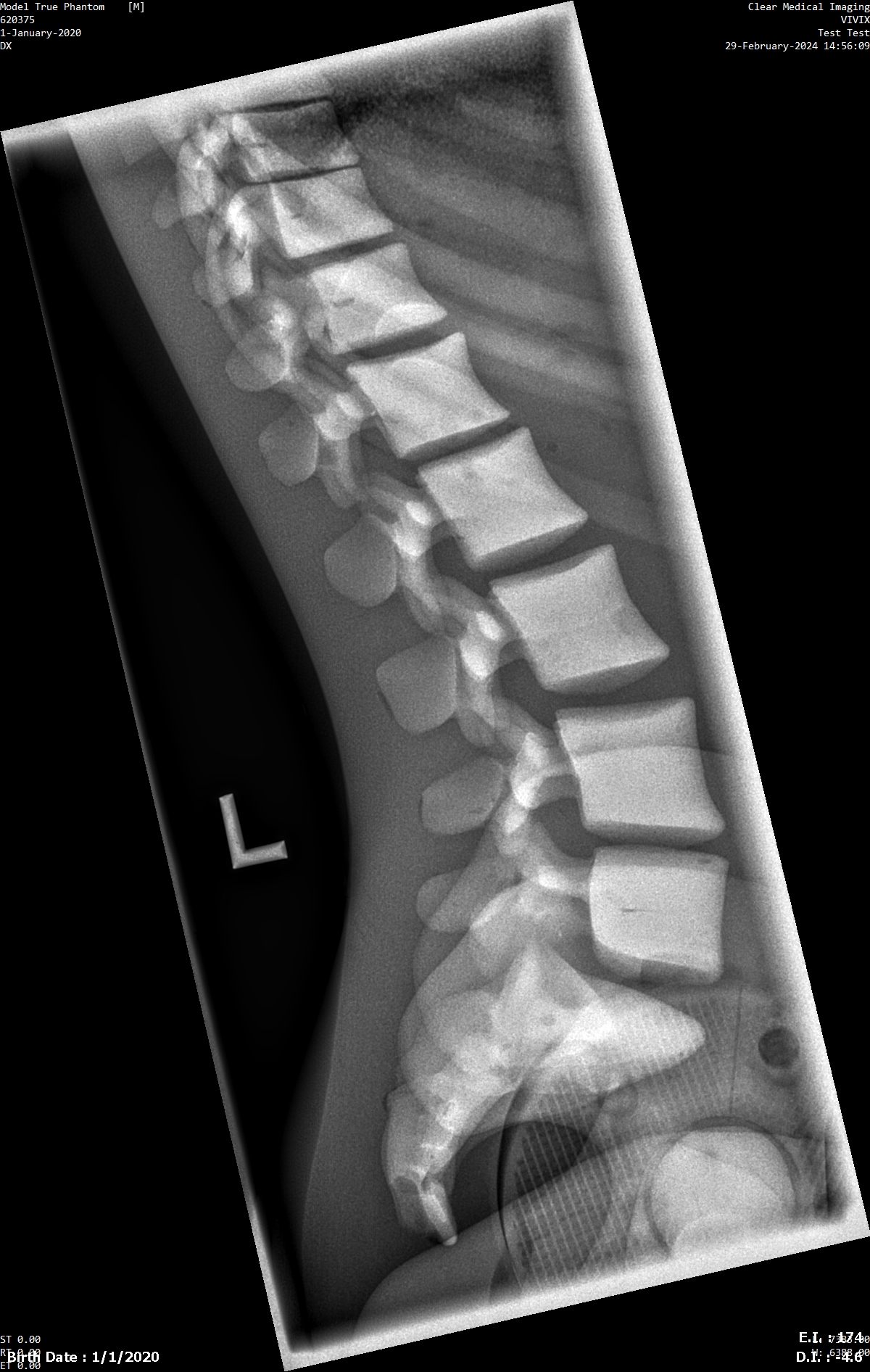 X-Ray Scans