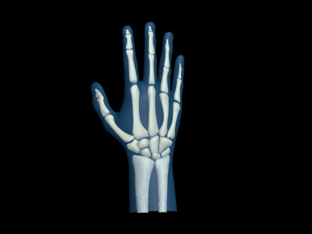 Design