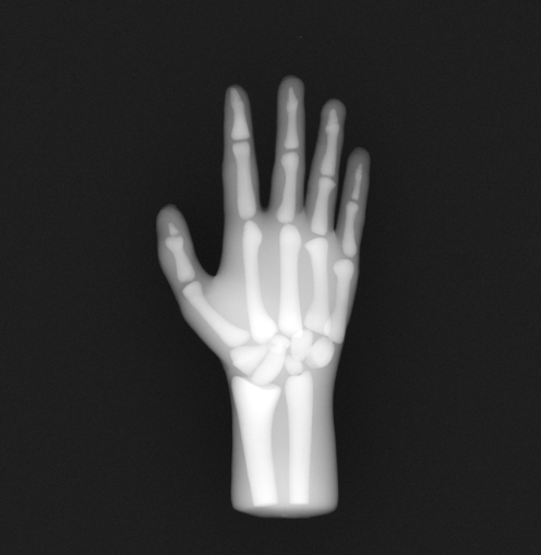 X-Ray Scans