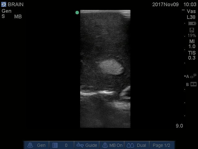 Ultrasound Scans