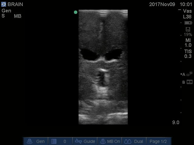 Ultrasound Scans